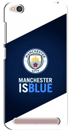 Чехол с принтом «Manchester is Blue» для Xiaomi Redmi 5A