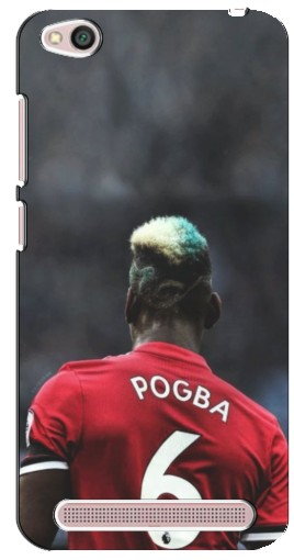 Чехол с печатью «Pogba 6»  для Xiaomi Redmi 5A