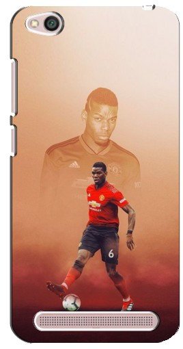 Чехол с печатью «Pogba с Манчестера»  для Xiaomi Redmi 5A