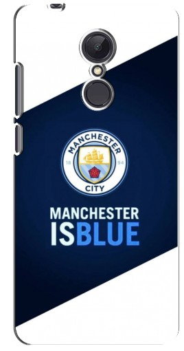 Чехол с картинкой «Manchester is Blue» для Xiaomi Redmi 5 Plus