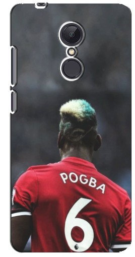 Чехол с принтом «Pogba 6» для Xiaomi Redmi 5 Plus