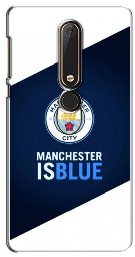 Силиконовый чехол с изображением «Manchester is Blue» для Nokia 6 2018